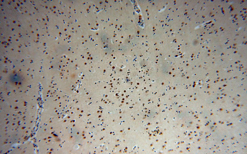 Immunohistochemical of paraffin-embedded human brain using Catalog No:109525(CPSF2 antibody) at dilution of 1:100 (under 10x lens)