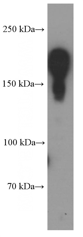 SKOV-3 cells were subjected to SDS PAGE followed by western blot with (BRCA1 Antibody) at dilution of 1:1000
