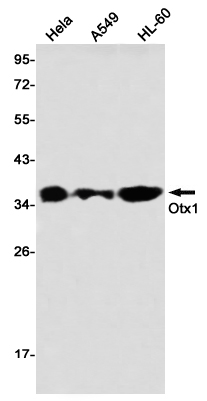 Western blot detection of Otx1 in Hela,A549,HL-60 using Otx1 Rabbit mAb(1:1000 diluted)