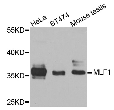 Western blot - MLF1 Polyclonal Antibody 