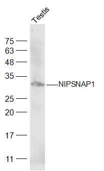 Fig1: Sample:; Testis (Mouse) Lysate at 40 ug; Primary: Anti-NIPSNAP1 at 1/300 dilution; Secondary: IRDye800CW Goat Anti-Rabbit IgG at 1/20000 dilution; Predicted band size: 33 kD; Observed band size: 33 kD