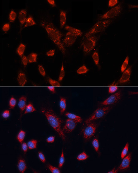 Immunofluorescence - DVL1 Polyclonal Antibody 