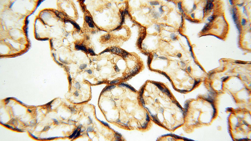 Immunohistochemical of paraffin-embedded human placenta using Catalog No:110546(FBXL8 antibody) at dilution of 1:50 (under 40x lens)