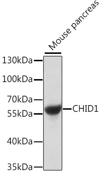 Western blot - CHID1 Polyclonal Antibody 