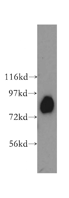 human skeletal muscle tissue were subjected to SDS PAGE followed by western blot with Catalog No:107742(ACO2 antibody) at dilution of 1:400