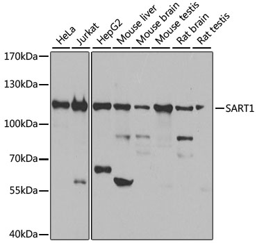 Western blot - SART1 Polyclonal Antibody 