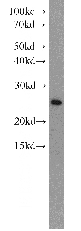 HEK-293 cells were subjected to SDS PAGE followed by western blot with Catalog No:108938(EIF4E antibody) at dilution of 1:1000