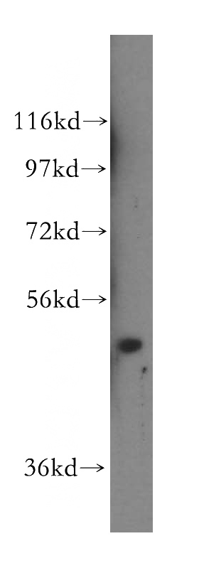 A549 cells were subjected to SDS PAGE followed by western blot with Catalog No:113164(NFS1 antibody) at dilution of 1:500