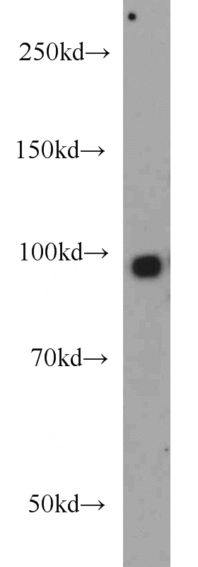 mouse brain tissue were subjected to SDS PAGE followed by western blot with Catalog No:115769(SYNPO antibody) at dilution of 1:1000
