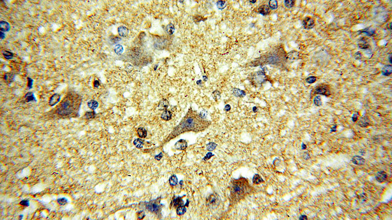 Immunohistochemical of paraffin-embedded human brain using Catalog No:112564(MCTP2 antibody) at dilution of 1:100 (under 40x lens)