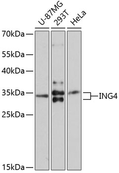 Western blot - ING4 Polyclonal Antibody 