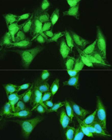 Immunofluorescence - KDM7A Polyclonal Antibody 