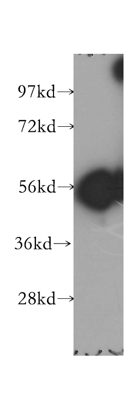 human lung tissue were subjected to SDS PAGE followed by western blot with Catalog No:111086(GLYCTK antibody) at dilution of 1:400