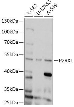 Western blot - P2RX1 Polyclonal Antibody 