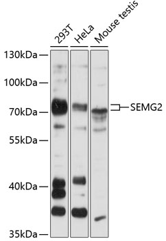 Western blot - SEMG2 Polyclonal Antibody 