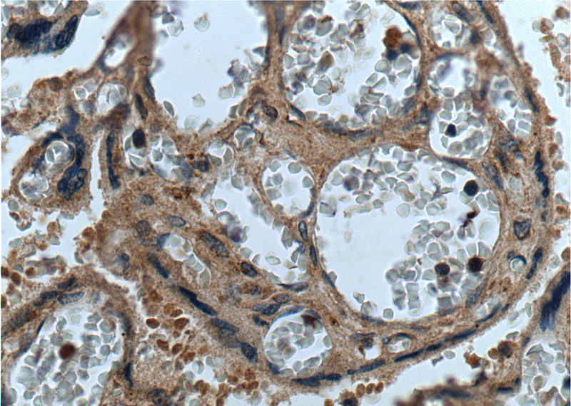 Immunohistochemistry of paraffin-embedded human placenta tissue slide using Catalog No:109270(CEP250,C-NAP1 Antibody) at dilution of 1:200 (under 40x lens).
