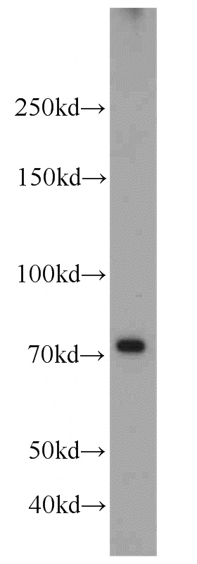 K-562 cells were subjected to SDS PAGE followed by western blot with Catalog No:114634(RFX3 antibody) at dilution of 1:600