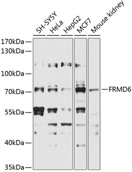Western blot - FRMD6 Polyclonal Antibody 