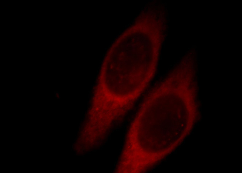 Immunofluorescent analysis of Hela cells, using GNL1 antibody Catalog No:111004 at 1:25 dilution and Rhodamine-labeled goat anti-rabbit IgG (red).