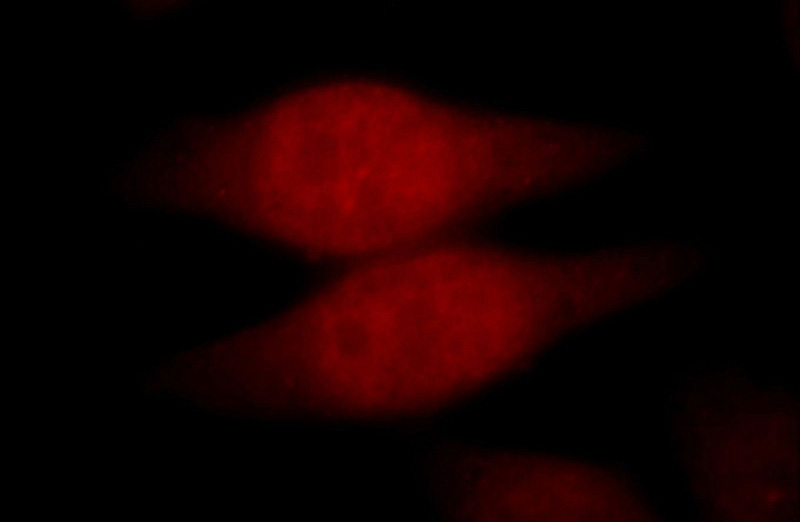 Immunofluorescent analysis of Hela cells, using CDC45L antibody Catalog No:109109 at 1:25 dilution and Rhodamine-labeled goat anti-rabbit IgG (red).