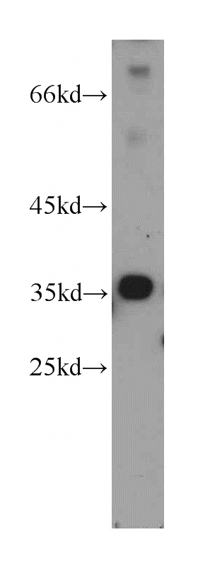 mouse brain tissue were subjected to SDS PAGE followed by western blot with Catalog No:112754(MPPED1 antibody) at dilution of 1:1500