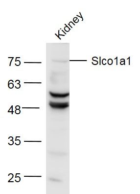 Fig3: Sample:; Kidney (Mouse) Lysate at 40 ug; Primary: Anti-Slco1a1 at 1/300 dilution; Secondary: IRDye800CW Goat Anti-Rabbit IgG at 1/20000 dilution; Predicted band size: 74 kD; Observed band size: 74 kD