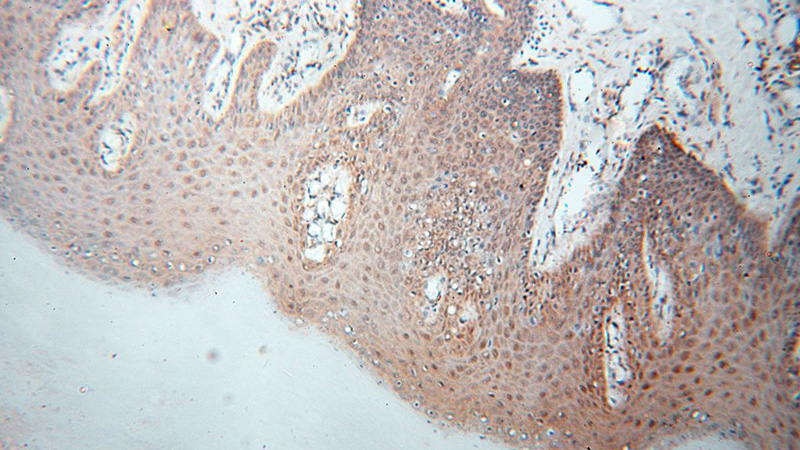 Immunohistochemical of paraffin-embedded human skin using Catalog No:116666(UBXN6 antibody) at dilution of 1:100 (under 10x lens)