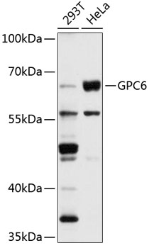 Western blot - GPC6 Polyclonal Antibody 