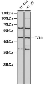 Western blot - TCN1 Polyclonal Antibody 