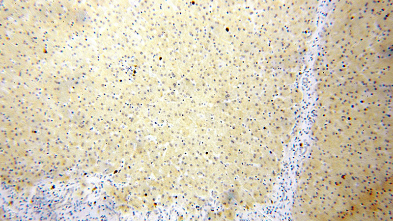 Immunohistochemical of paraffin-embedded human liver using Catalog No:111550(HSD17B7P2 antibody) at dilution of 1:50 (under 10x lens)