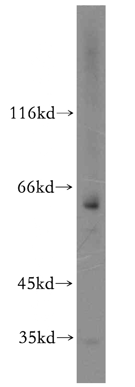 HeLa cells were subjected to SDS PAGE followed by western blot with Catalog No:116499(PEO1 antibody) at dilution of 1:300