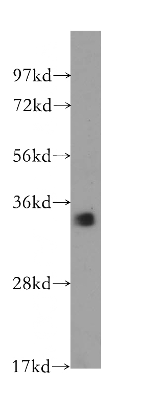 human pancreas tissue were subjected to SDS PAGE followed by western blot with Catalog No:109102(CDC34 antibody) at dilution of 1:300