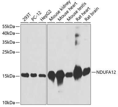 Western blot - NDUFA12 Polyclonal Antibody 