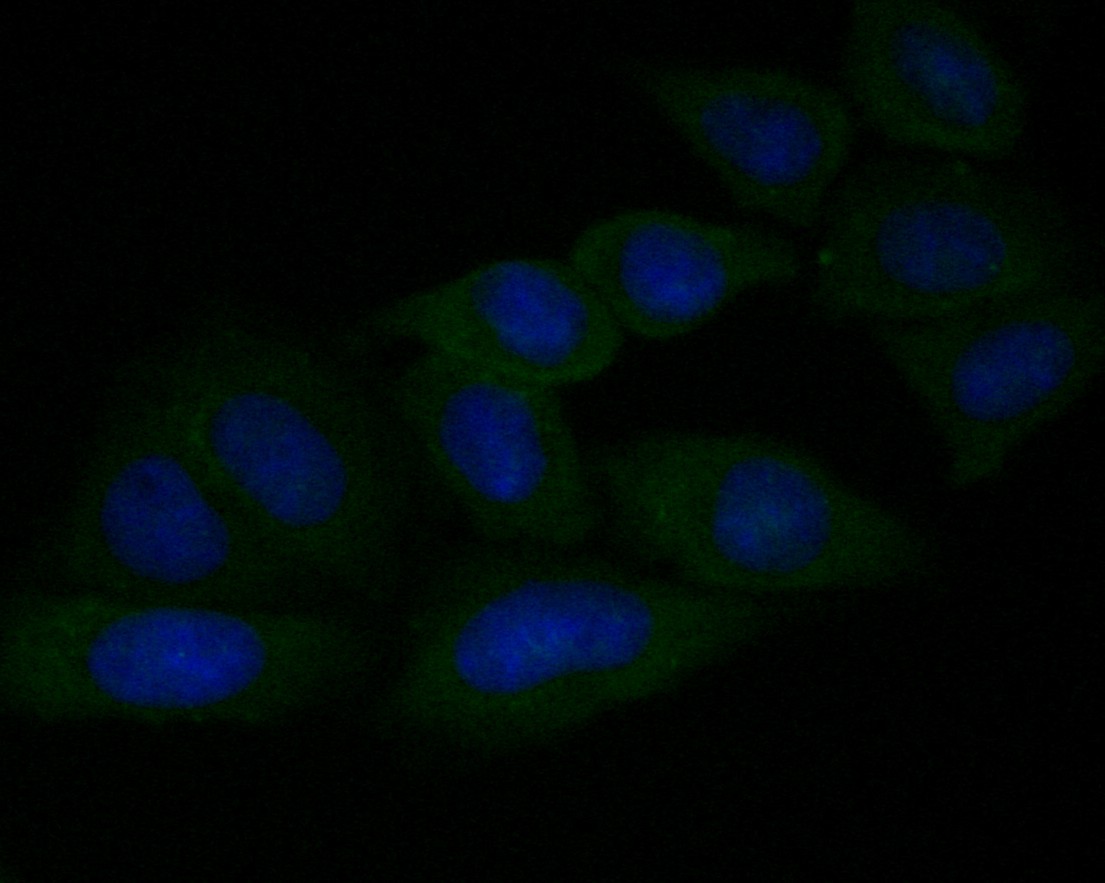 Fig2: ICC staining of Gasdermin D in SiHa cells (green). Formalin fixed cells were permeabilized with 0.1% Triton X-100 in TBS for 10 minutes at room temperature and blocked with 1% Blocker BSA for 15 minutes at room temperature. Cells were probed with the primary antibody ( 1/50) for 1 hour at room temperature, washed with PBS. Alexa Fluor®488 Goat anti-Rabbit IgG was used as the secondary antibody at 1/1,000 dilution. The nuclear counter stain is DAPI (blue).