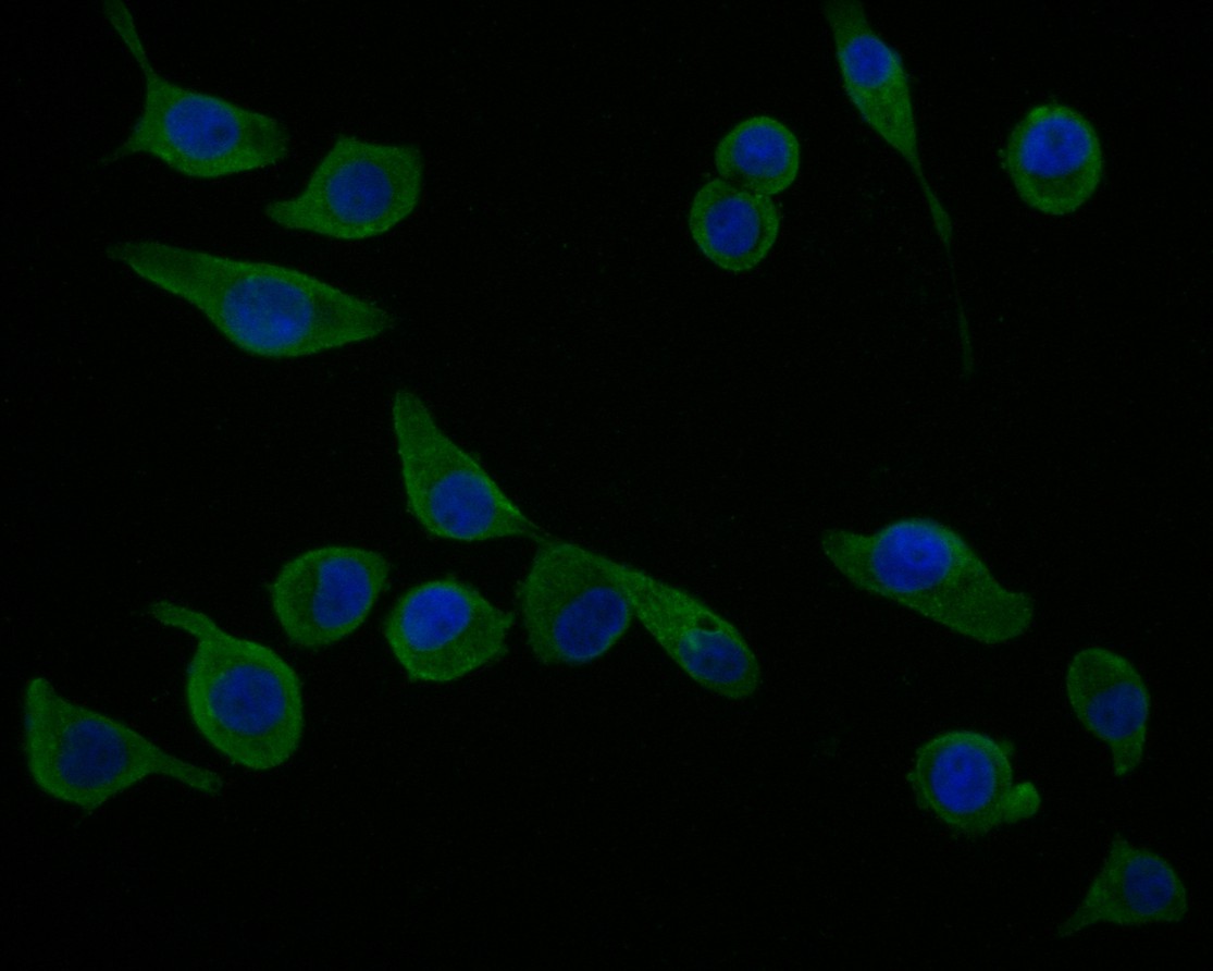 Fig3:; ICC staining of cGAS in LOVO cells (green). Formalin fixed cells were permeabilized with 0.1% Triton X-100 in TBS for 10 minutes at room temperature and blocked with 1% Blocker BSA for 15 minutes at room temperature. Cells were probed with the primary antibody ( 1/100) for 1 hour at room temperature, washed with PBS. Alexa Fluor®488 Goat anti-Rabbit IgG was used as the secondary antibody at 1/1,000 dilution. The nuclear counter stain is DAPI (blue).
