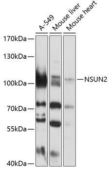 Western blot - NSUN2 Polyclonal Antibody 