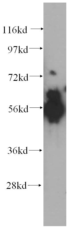 human kidney tissue were subjected to SDS PAGE followed by western blot with Catalog No:108306(ATP6V1B1 antibody) at dilution of 1:400