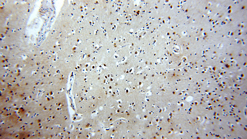 Immunohistochemical of paraffin-embedded human brain using Catalog No:111355(HIP1-Specific antibody) at dilution of 1:100 (under 10x lens)