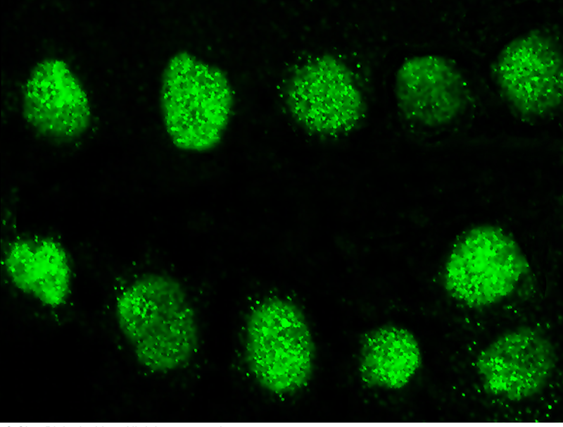 Human GCM2 Immunofluorescence(IF) 15190