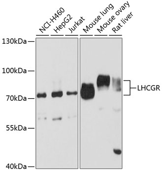 Western blot - LHCGR Polyclonal Antibody 
