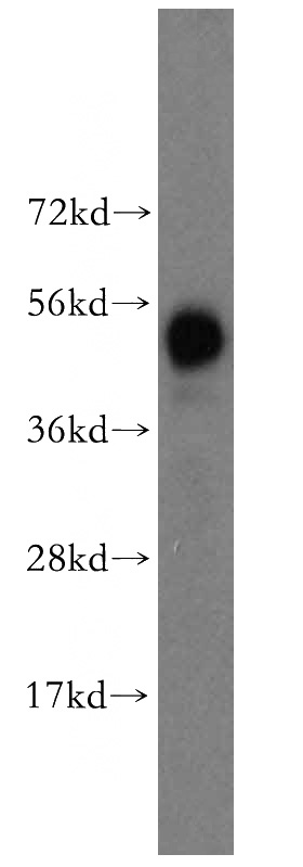mouse liver tissue were subjected to SDS PAGE followed by western blot with Catalog No:111256(HARS antibody) at dilution of 1:500