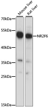 Western blot - NR2F6 Polyclonal Antibody 