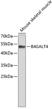 Western blot - B4GALT4 Polyclonal Antibody 