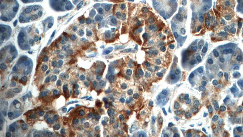 Immunohistochemistry of paraffin-embedded human pancreas tissue slide using Catalog No:108614(C18orf21 Antibody) at dilution of 1:50 (under 40x lens)