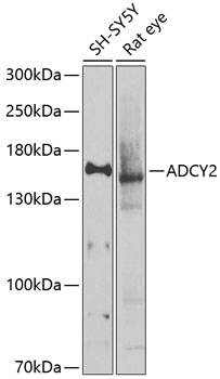 Western blot - ADCY2 Polyclonal Antibody 