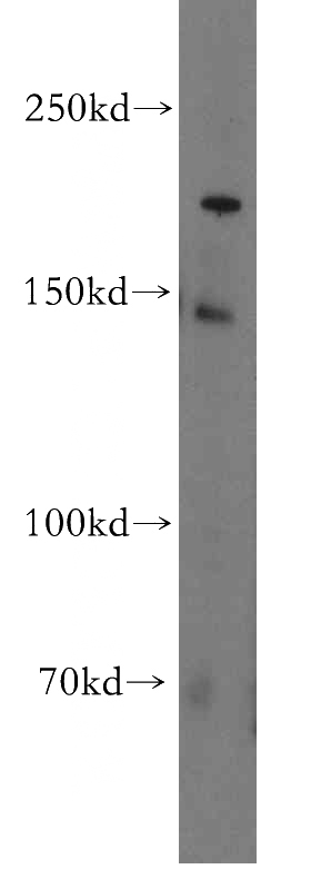 HT-1080 cells were subjected to SDS PAGE followed by western blot with Catalog No:113638(PDS5B antibody) at dilution of 1:500