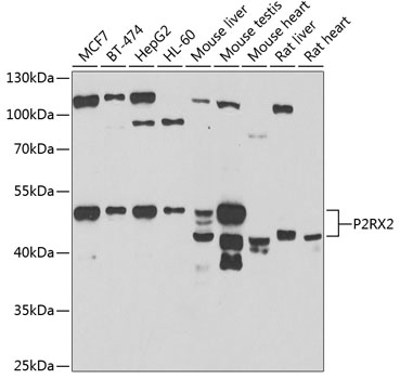 Western blot - P2RX2 Polyclonal Antibody 