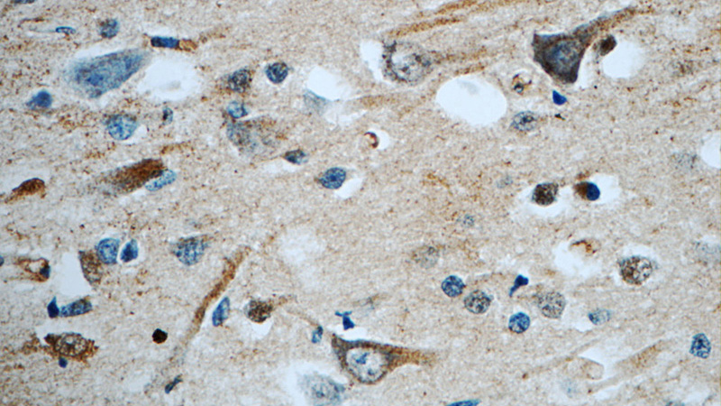 Immunohistochemistry of paraffin-embedded human brain tissue slide using Catalog No:111718(ELAVL3 Antibody) at dilution of 1:50 (under 40x lens)