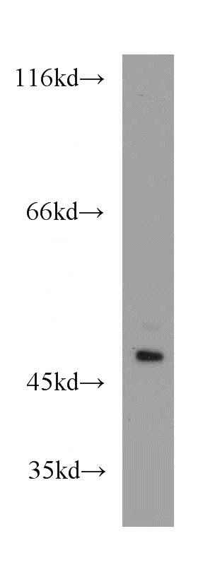Jurkat cells were subjected to SDS PAGE followed by western blot with Catalog No:113493(PAICS antibody) at dilution of 1:1000
