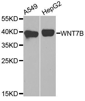 Western blot - WNT7B Polyclonal Antibody 